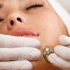 Image 4: Hydrate and Glow Up with Hydrafacial and Skin Tightening