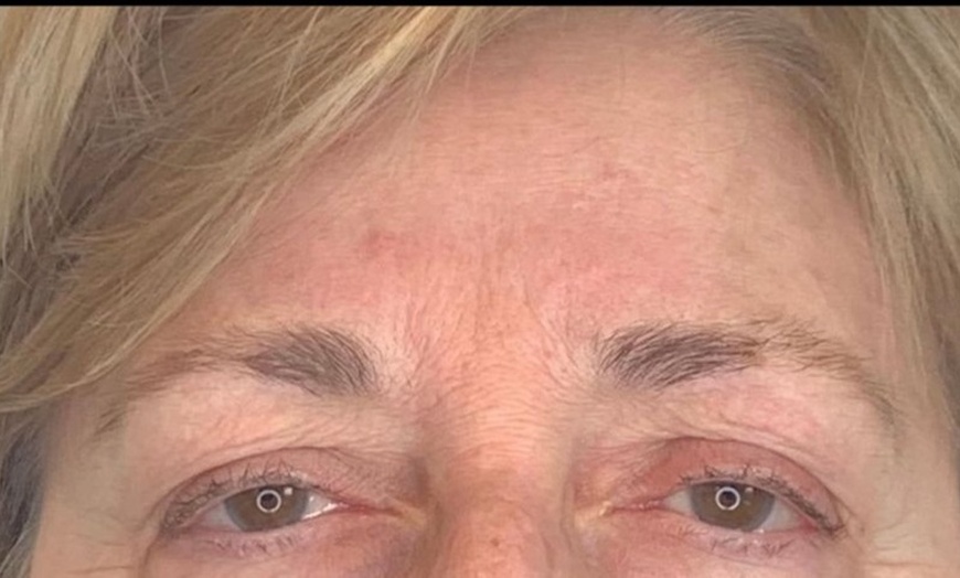 Image 7: Permanente make-up voor een verzorgde look, elke dag opnieuw