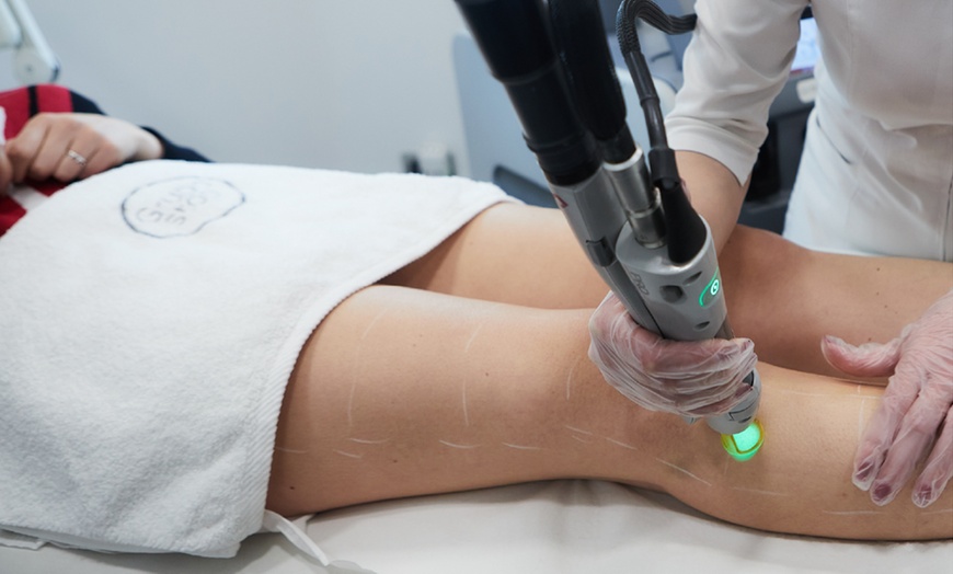 Image 5: Depilación láser DúoTechnology® para mujer y hombre en zonas clave
