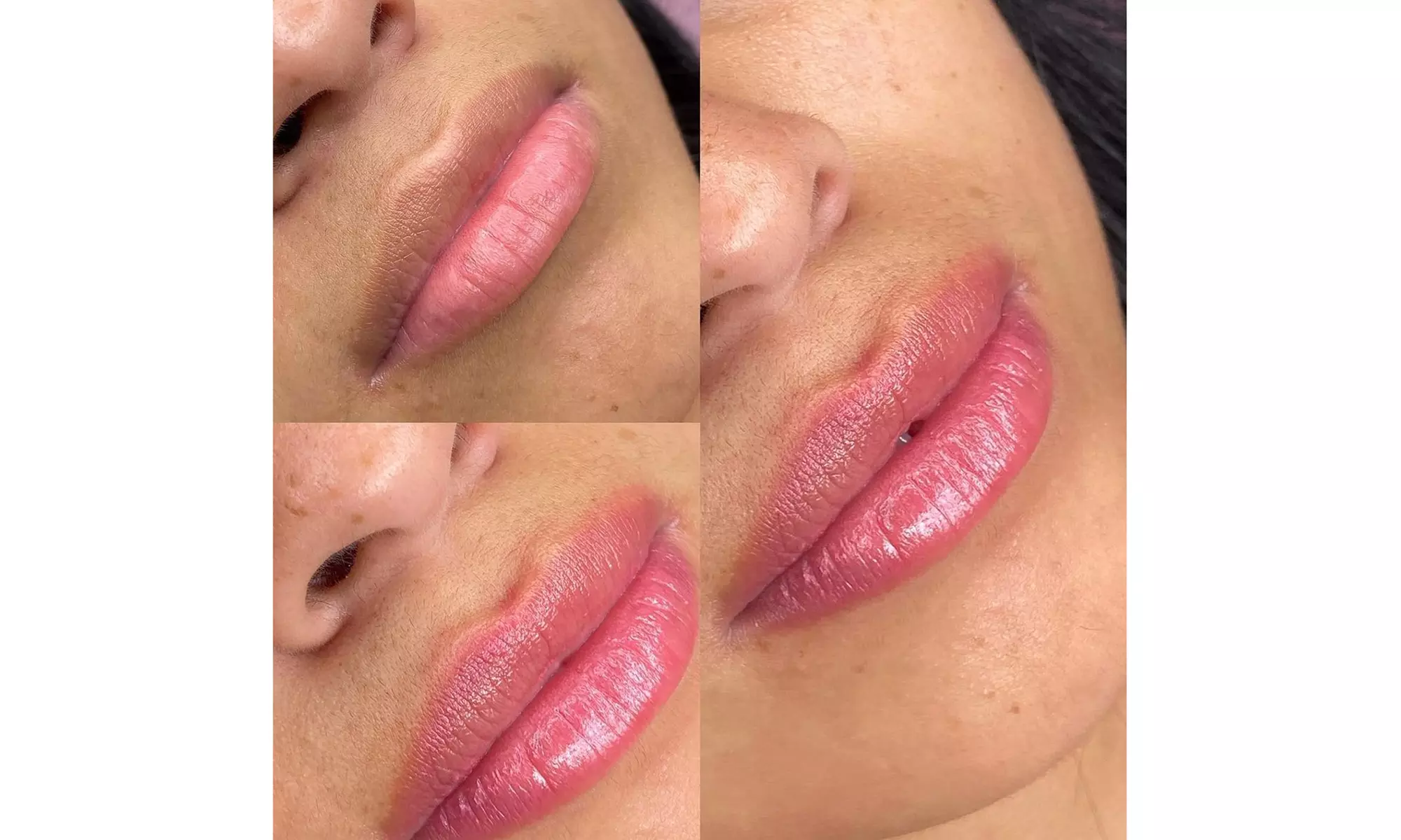 Lip Blushing or Dark Lip Magic Sessions with One Virtual Consultation