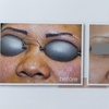 Image 4: 3 Laser Tattoo Removal Sessions: Small, Medium, Large or XL Areas