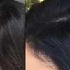 Image 2: Restore Confidence with Scalp Micropigmentation at Rose Beauty Bar