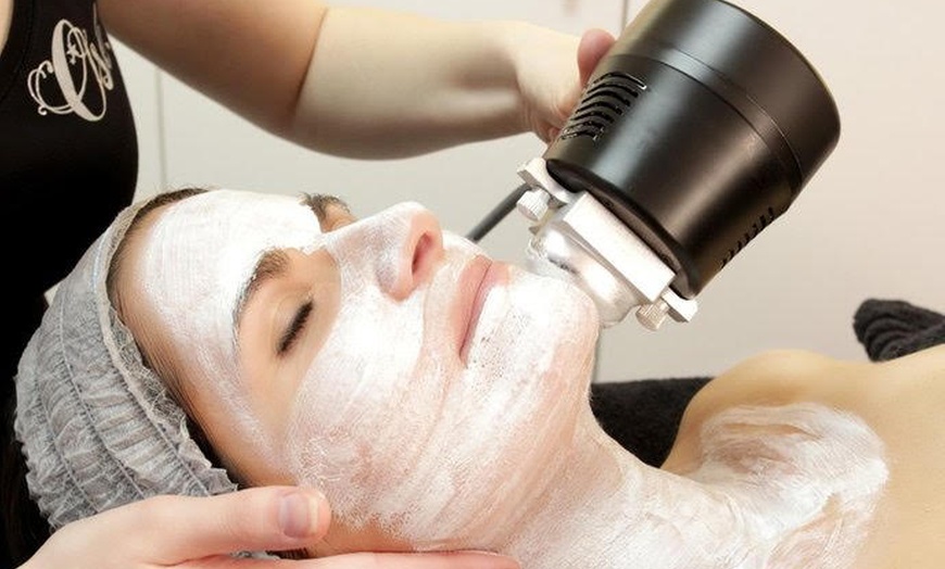 Image 1: Microdermabrasion avec cellules souches