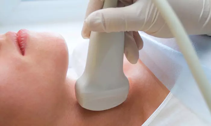 Smooth Fine Lines with Non-Invasive Radio Frequency Skin Tightening