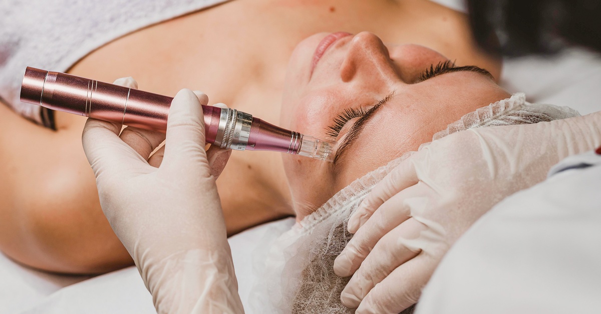 Sesión de microneedling facial en una clínica de Tarragona
