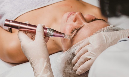 1 sesión de microneedling facial - Clinica Odita