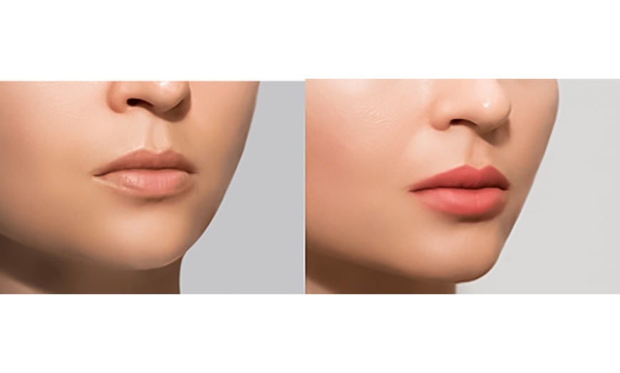 Image 5: Teeth Whitening, Semi Permanent Lip Blush or Powder Brows Perfection 