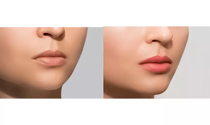 Teeth Whitening, Semi Permanent Lip Blush or Powder Brows Perfection