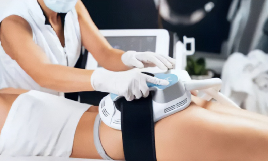 Image 1: 2 o 4 sesiones de electroestimulación y masaje reductor