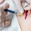 Image 1: Enhance Your Look: 1 or 2 Full Syringes of Restylane Kysse for Lips
