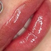 Image 3: Up to 40% Off on Lip Enhancement at Blushed and Body Cosmetics