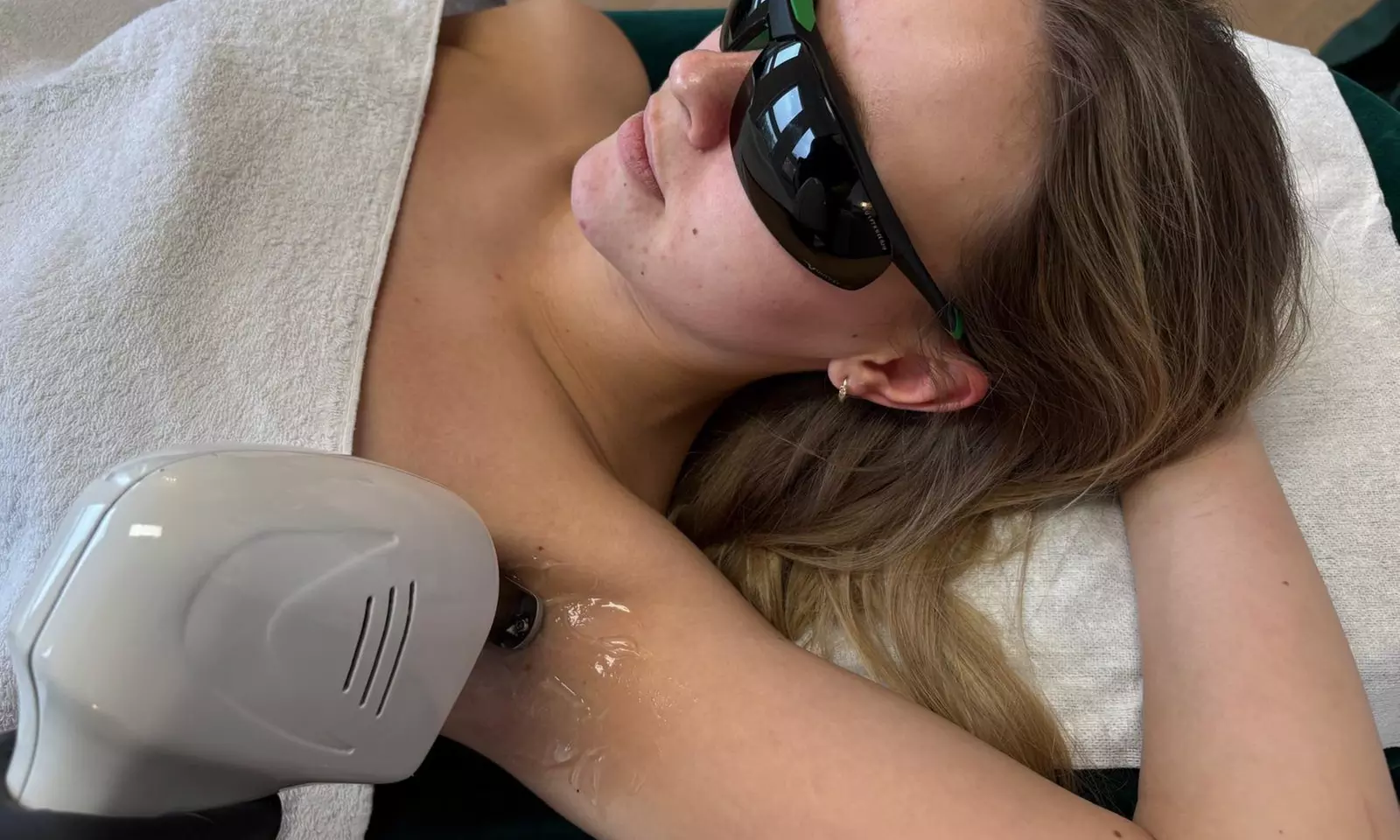 Depilacja laserowa wybranej partii ciała – 1 lub 3 zabiegi