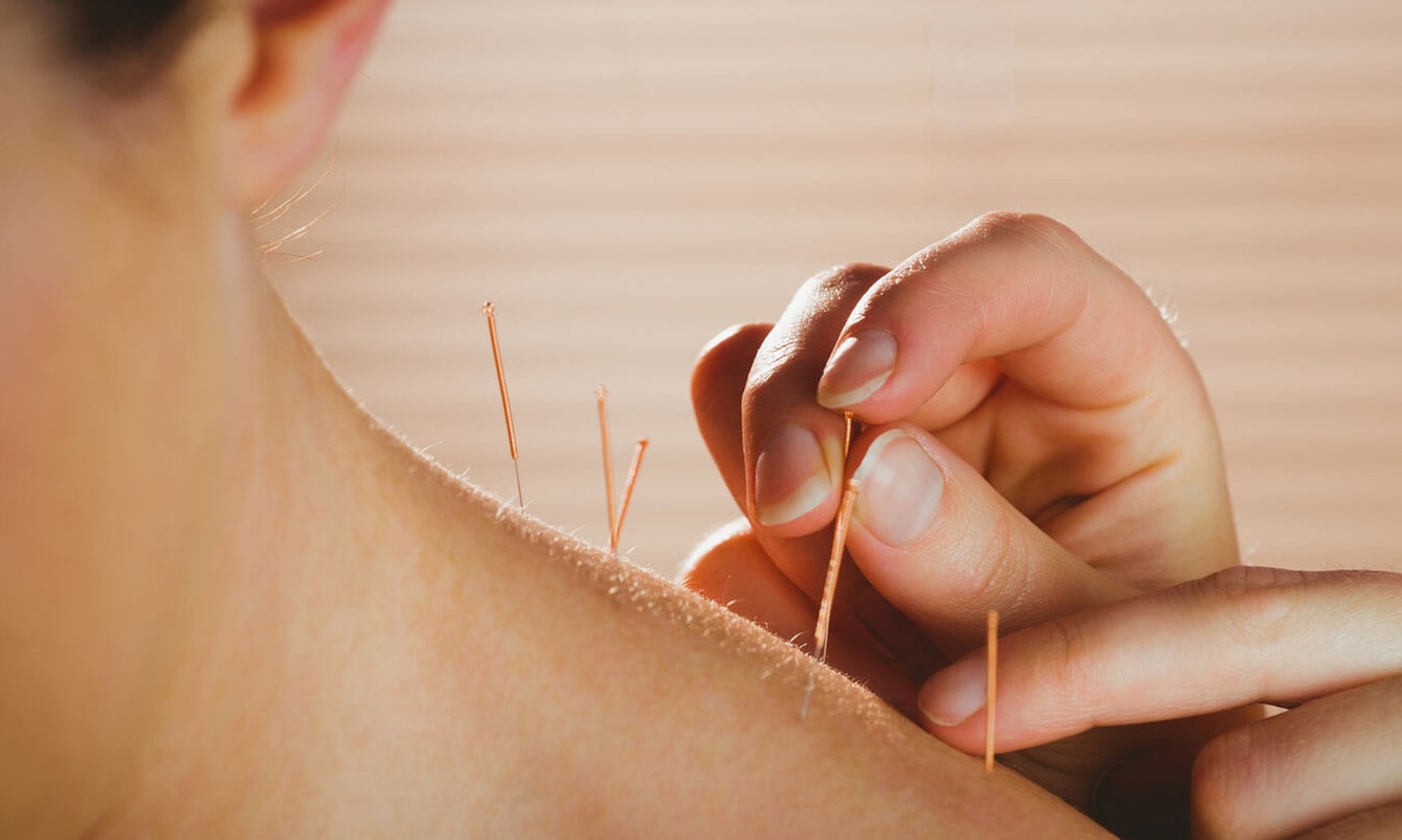 Acupuncture & Massage Packages – Single or Two-Session Options
