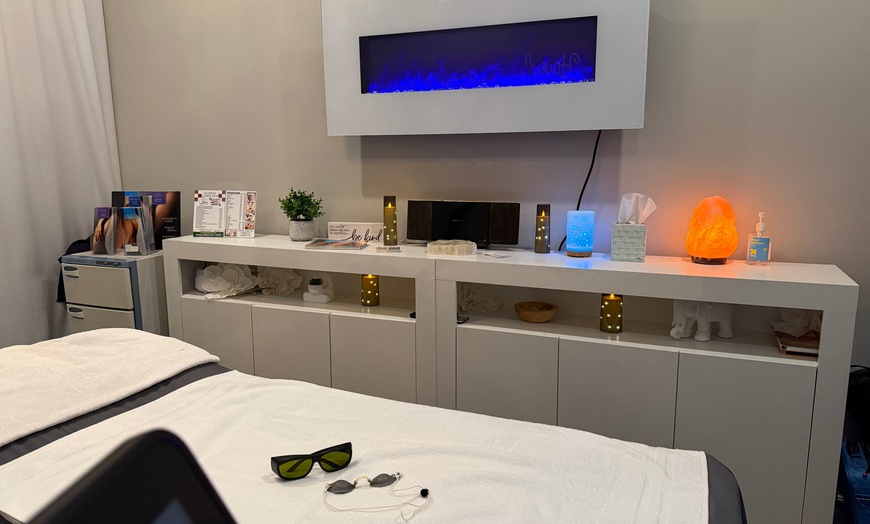 Image 2: Spider Vein Removal for a 2x2 / 4x4 Area Or Full Leg Treatment