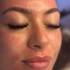 Image 1: One or Three Microneedling Sessions with Skin Booster