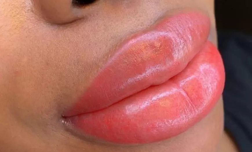 Image 6: Met Semi-permanente make-up vollere strakkere lippen