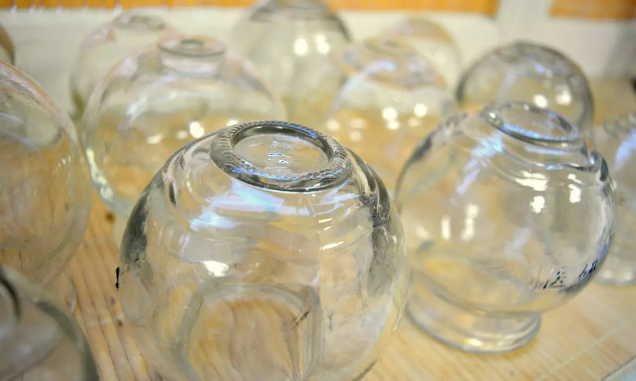 Schröpfenmassage inkl. TCM-Diagnose und opt. Akupunktur