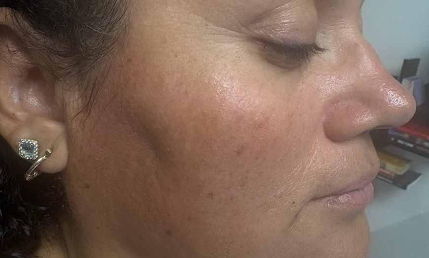 Image 6: Experience Full Face Threading Including Eyebrow, and Lips