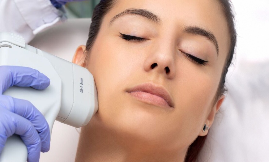 Image 1: 1 o 2 sesiones de HIFU facial con vitaminas y opción a fotolifting