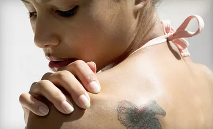 One, Three, or Six Laser Tattoo-Removal Sessions at Toronto Ink Tattoo and Laser Studio in Scarborough (Up to 85% Off) - Primary Image