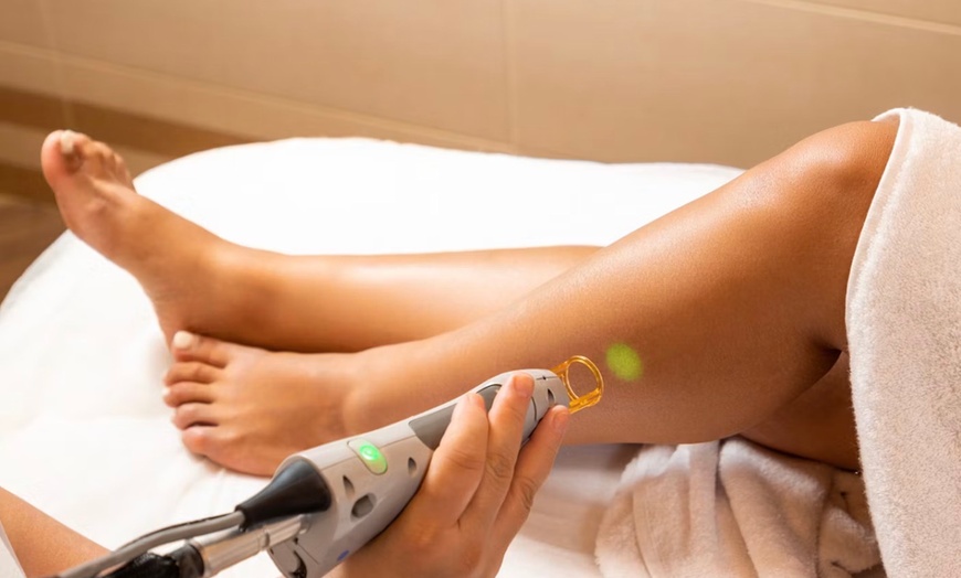 Image 4: Laser Hair Removal Sessions