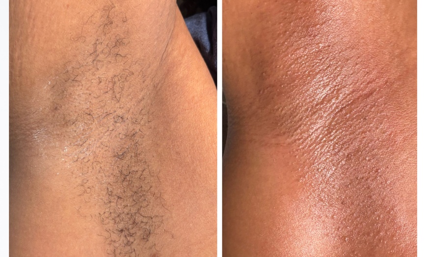 Image 4: Up to 55% Off on Brazilian / Bikini Waxing at BARE AND SMOOTH ESTHETICS LLC