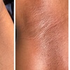 Image 4: Up to 55% Off on Brazilian / Bikini Waxing at BARE AND SMOOTH ESTHETICS LLC
