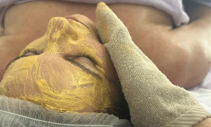 Image 3: Limpieza facial, ultrasonido con mascarilla o radiofrecuencia