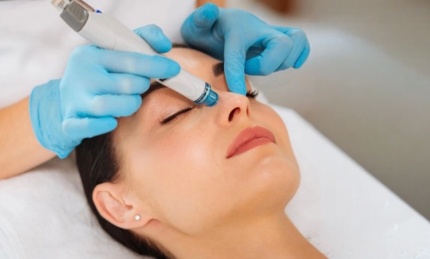 Image 2: Transform Your Look w/1, 2 or 3ml of Premium Non-Surgical Augmentation