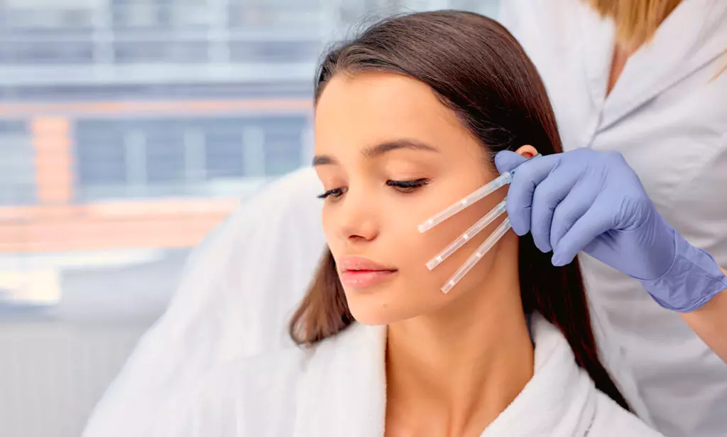 6 o 12 hilos tensores para tratamiento reafirmante facial para 1