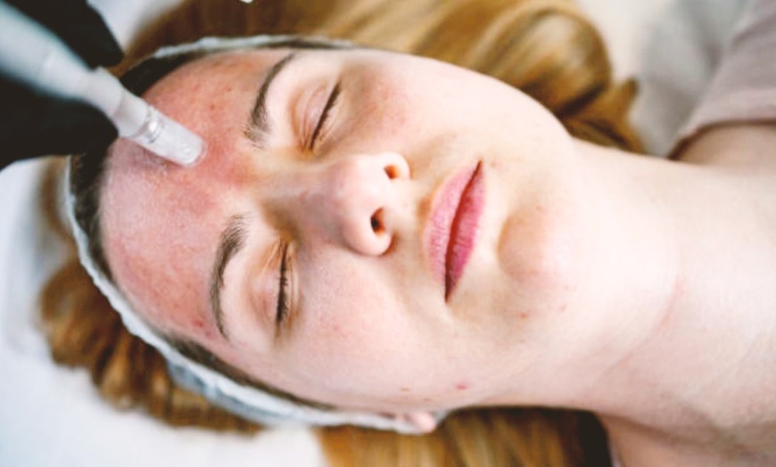 Image 9: Limpieza facial con tratamiento antiarrugas, hydralips, relleno y más