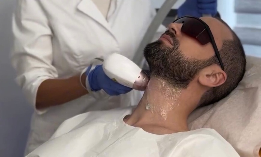 Image 4: 6 Laser Hair Removal Session-1 Small, Medium Large or Extra Large Area