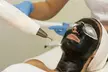 1 o 2 sesiones de Hollywood Peel facial con carbón activo y opción a fototerapia para 1 persona, al 55% - Image 3