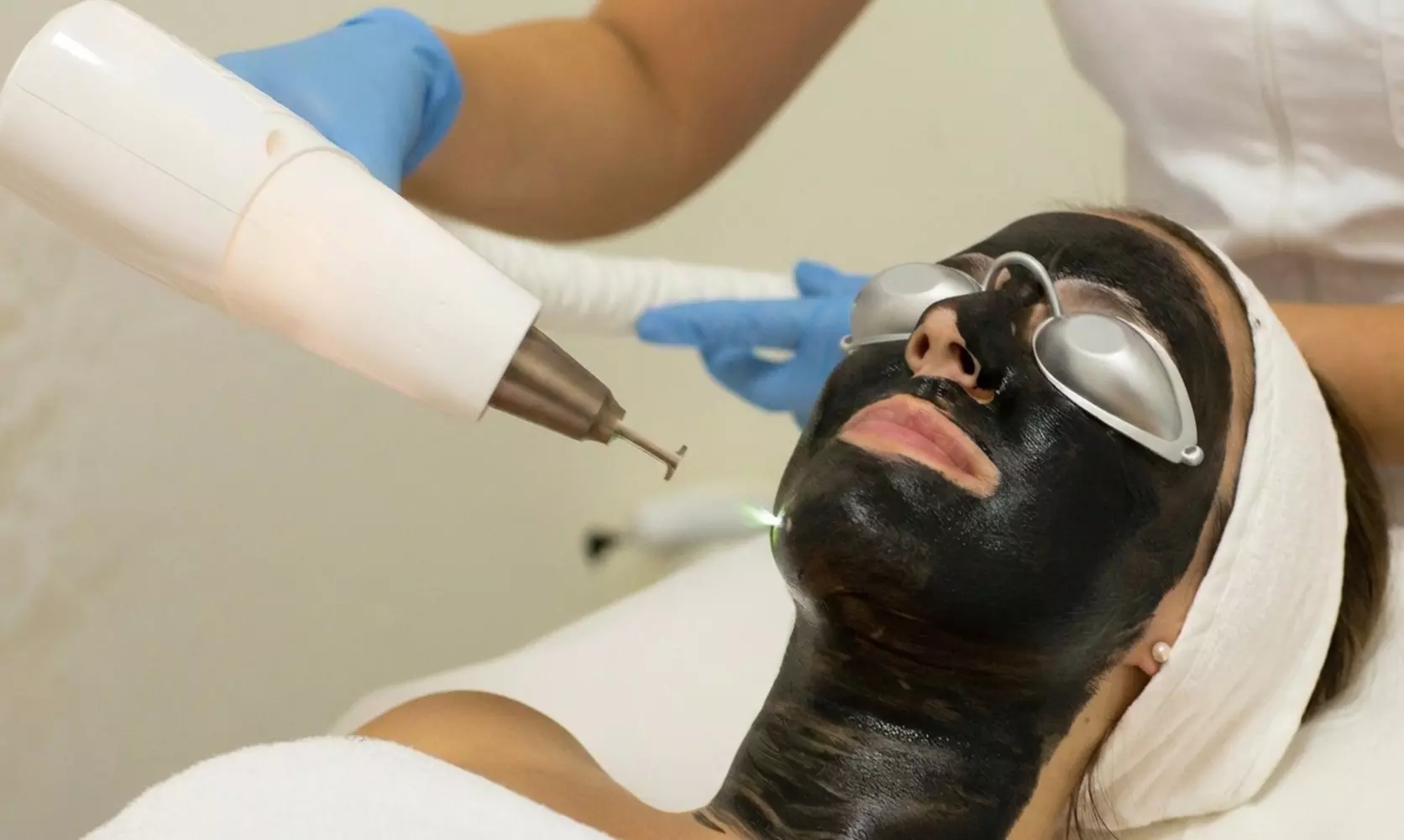 Tratamiento facial Hollywood Peel con mascarilla de carbón activo