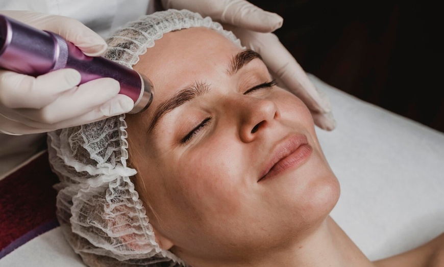 Image 4: Higiene facial, con microdermoabrasión, radiofrecuencia y máscara led
