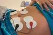 3 o 6 sesiones de 30 minutos de electroestimulación muscular en una zona, con opción a drenaje manual, para 1 persona - Second Medium