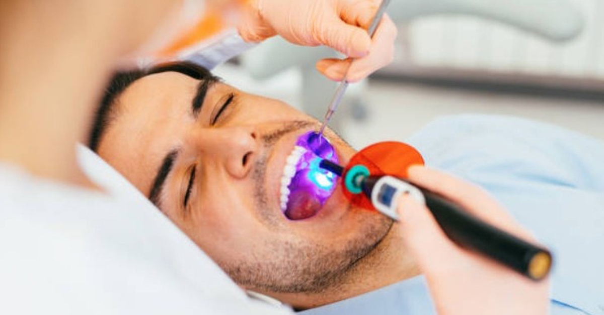 Sesiones de blanqueamiento dental LED con limpieza bucal en Valencia