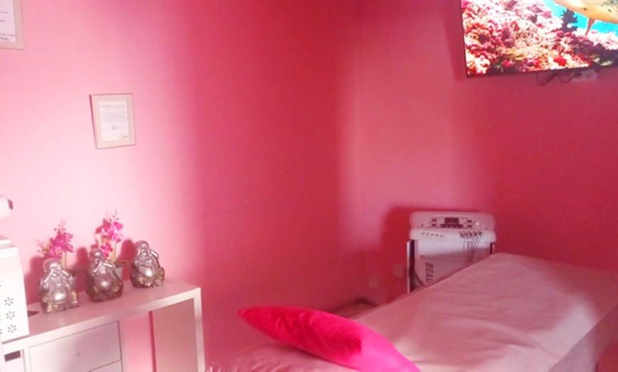 Image 5: Tratamiento facial con dermapen con cóctel de vitaminas o exosomas