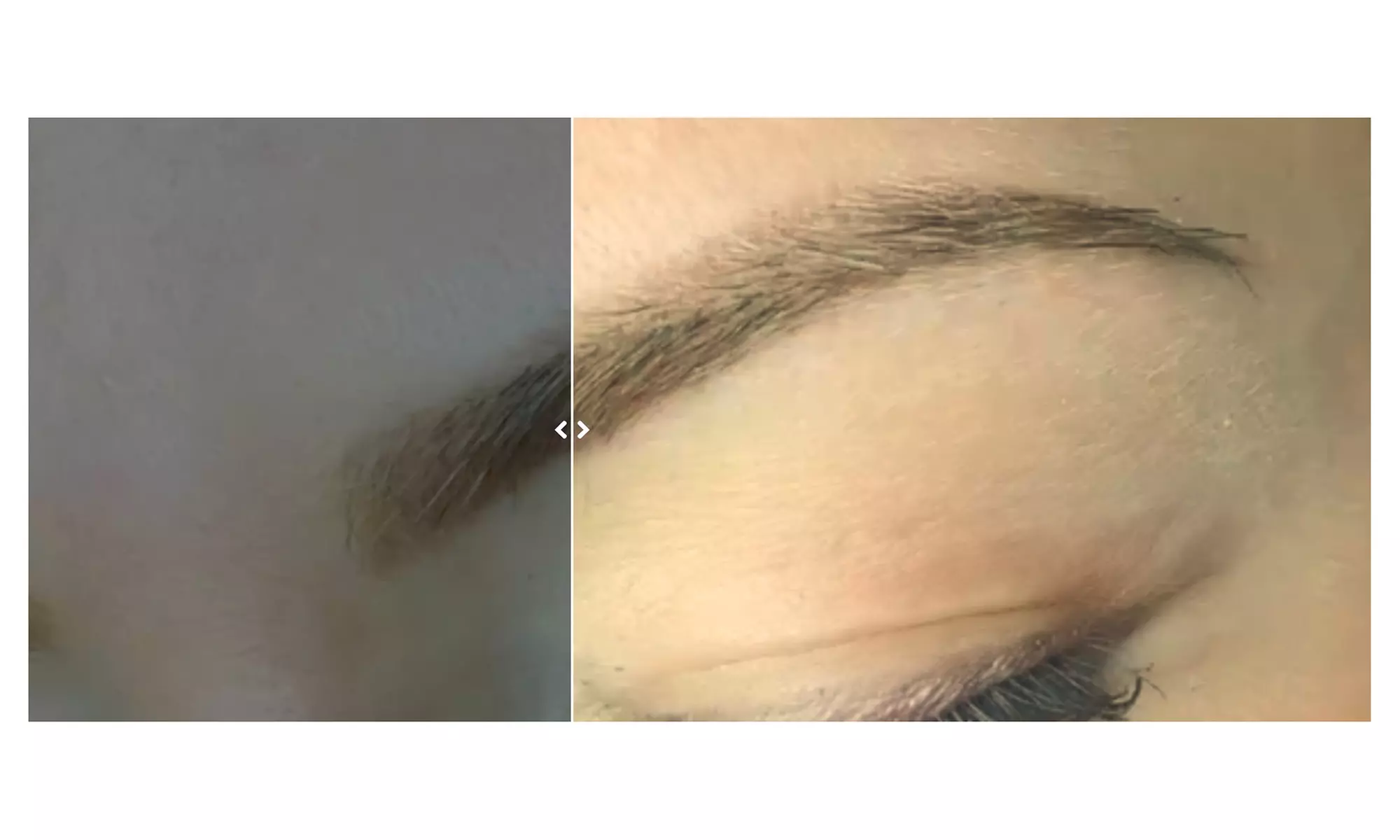 Enhance Beauty with Microblading, Lip Blush and More! 