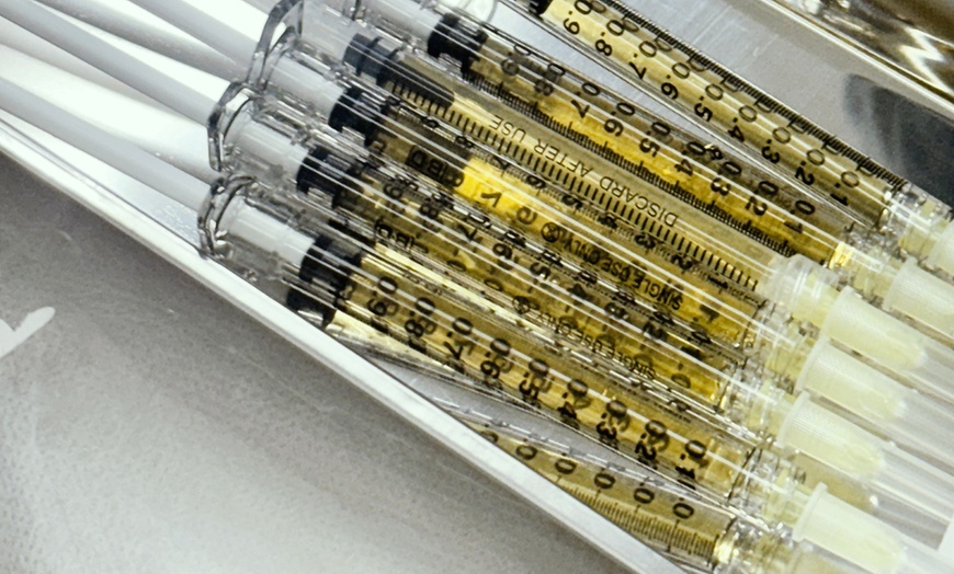 Image 4: Revitalize w/ 1,2,or 3 Sessions of PRP Full Face Includes Under eyes 