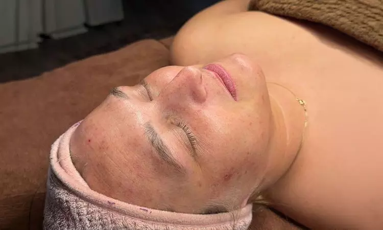 1 or 3 Woman Scalp Revival Treatment or Headspa w/ Hydra-Bliss Facial