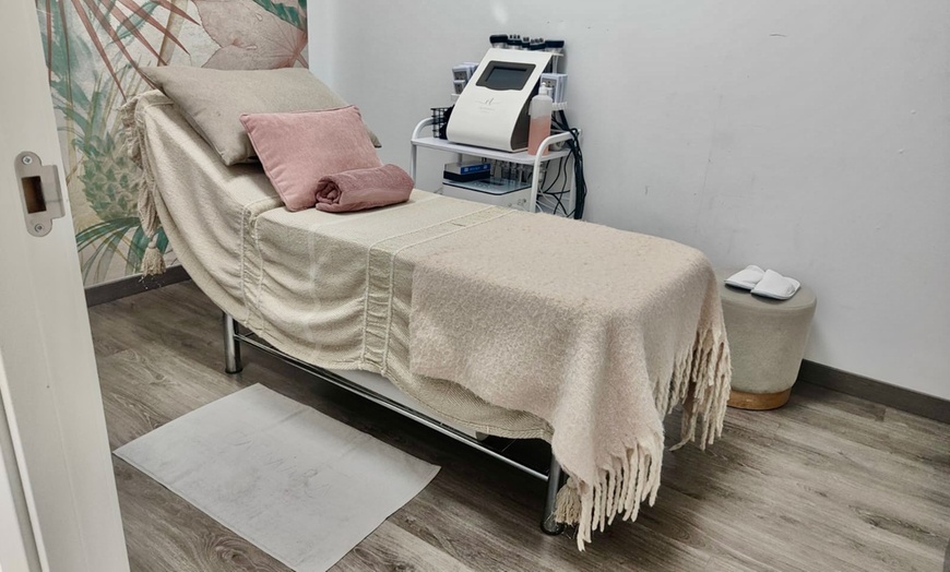 Image 2: Limpieza facial con opción a microdermoabrasión y radiofrecuencia