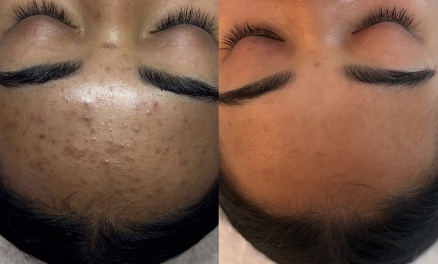 Image 2: 60-Minute 'Reset Series' Facial for Skin Balance & Clarity