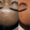 Image 2: 60-Minute 'Reset Series' Facial for Skin Balance & Clarity
