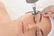 1 o 2 sesiones de radiofrecuencia Indiba facial o corporal para 1 persona, ahorra hasta un 67% - Image 5