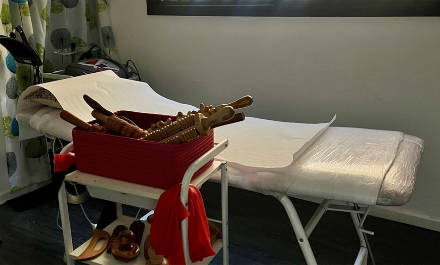 Image 3: Tratamiento facial Dermapen con cóctel rejuvenecedor y extras 