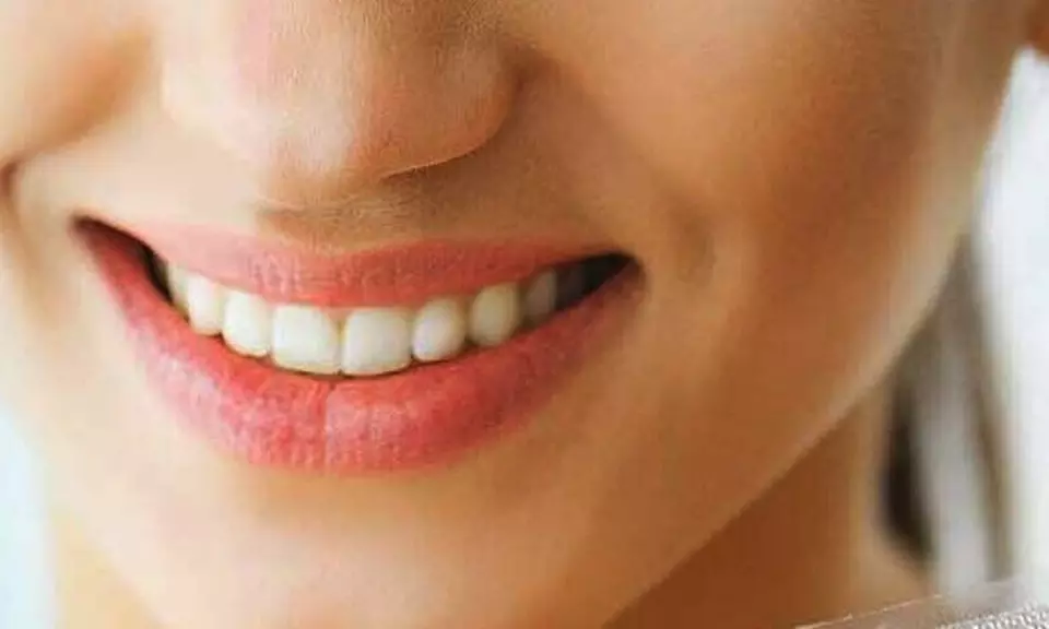 MySmile 56PC Teeth Whitening Strips, Whitening Strips for Sensitive Teeth