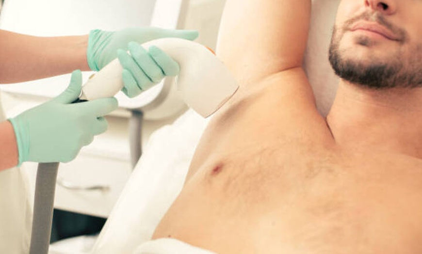 Image 3: 1, 3, 5 o 7 sesiones de depilación láser en zona a elegir 