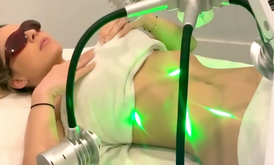 Image 1: Tone Your Body with One, Three, or Six Sessions of Laser Fat Removal