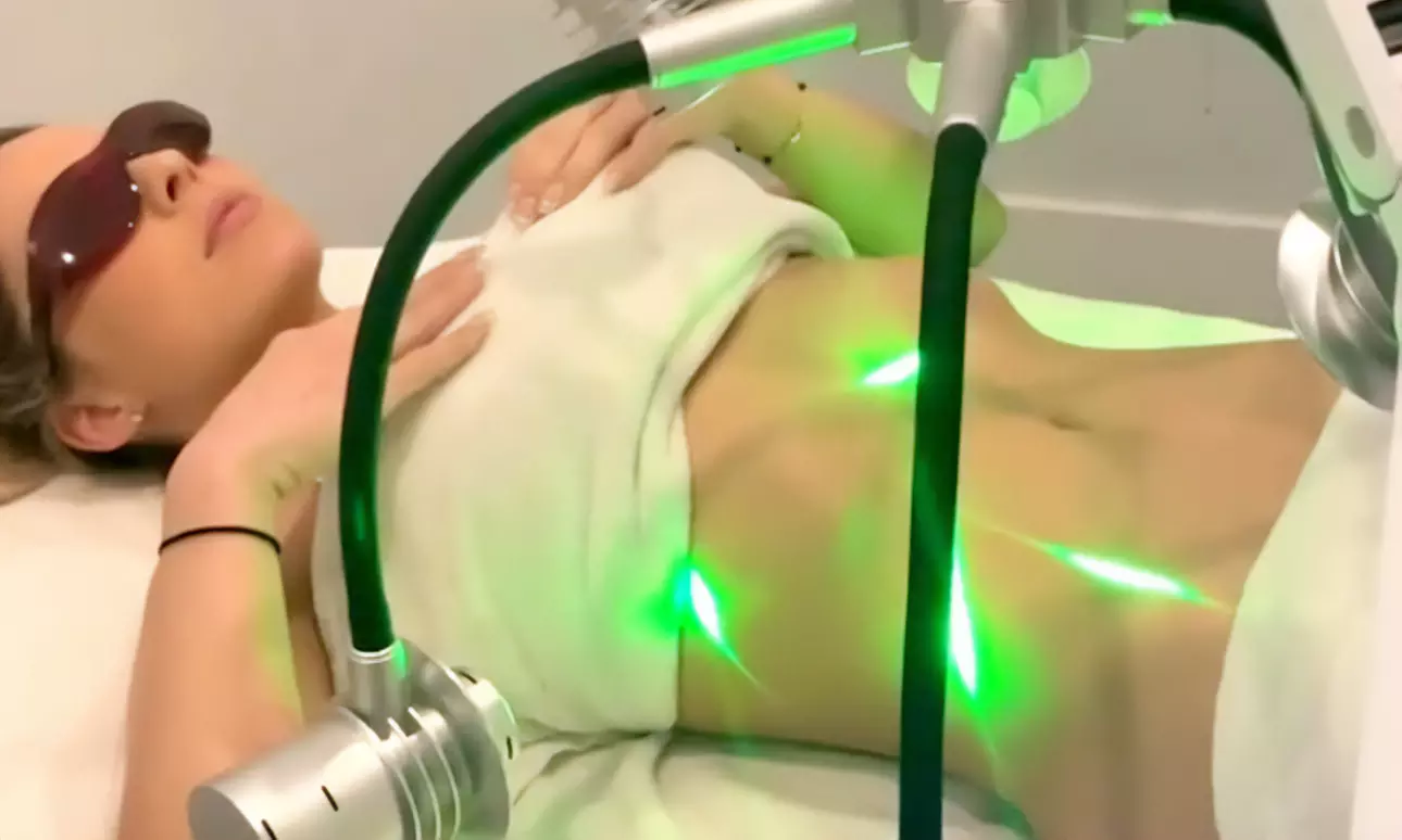 Sculpt Your Body with One, Three, or Six Sessions of Laser Fat Removal at Destiny Med Spa (Up to 73%Off) - Primary Image
